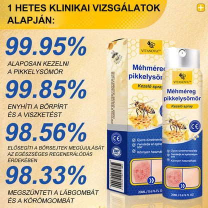 (🔥 60% kedvezmény az utolsó napi csomag vásárlásához 🔥) VitaNova™ PsoriaHeal psoriasis Spray pro🔥Globális szállítás