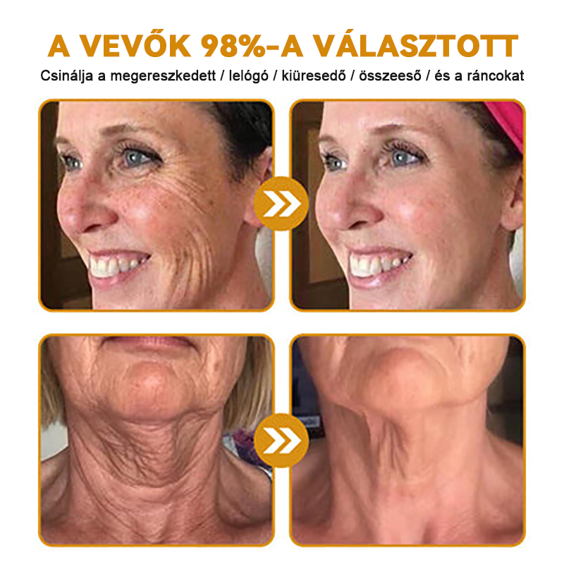 🏵️🏵️【Hivatalos Márkabolt】FRISSARC™ Botox Méhméreg Ránctalanító Krém