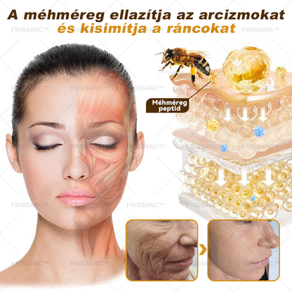 🏵️🏵️【Hivatalos Márkabolt】FRISSARC™ Botox Méhméreg Ránctalanító Krém