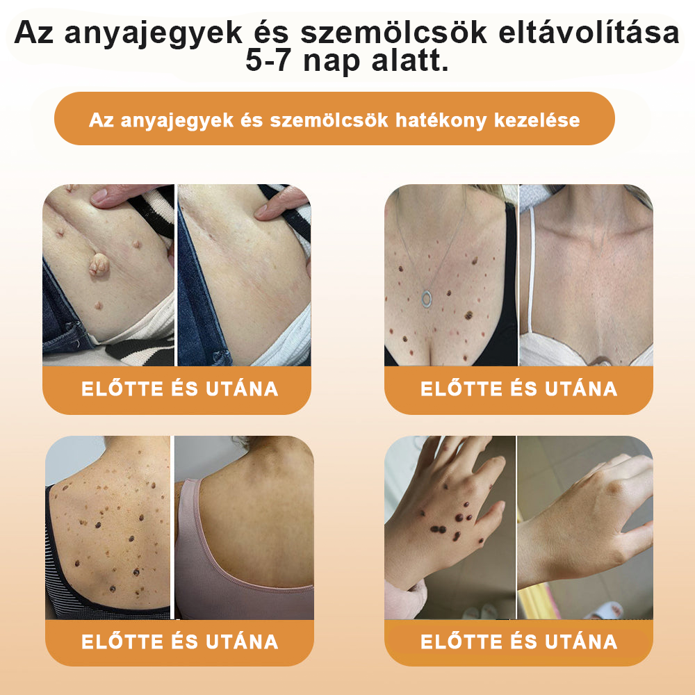 🌿🌿𝑻𝒖𝒓𝒐𝒏𝒖™ méhméreg kezelő krém [🌿Bőrszakértők által ajánlott]