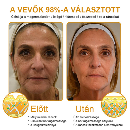 🏵️🏵️【Hivatalos Márkabolt】FRISSARC™ Botox Méhméreg Ránctalanító Krém