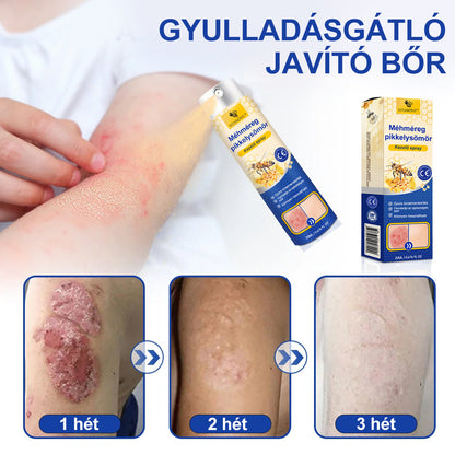 (🔥 60% kedvezmény az utolsó napi csomag vásárlásához 🔥) VitaNova™ PsoriaHeal psoriasis Spray pro🔥Globális szállítás