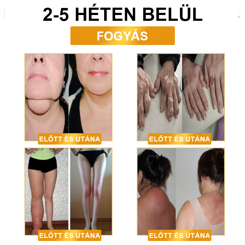 🥑𝐉𝐎𝐒𝐅𝐈𝐓™ Ultrahangos cellulit eltávolító és méregtelenítő karkötő💥