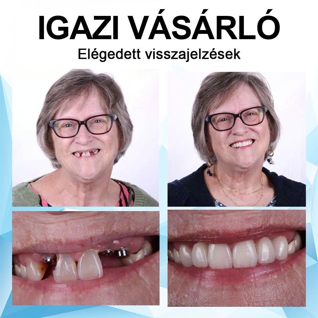 🦷Furzero™ szilikon műfogsor készlet🦷