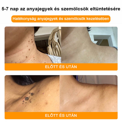 🐝💖BSWELL® Méhméreg Kezelés Krém👨‍⚕️（AAD ajánlott） (🔥utolsó nap promóció 80% ki