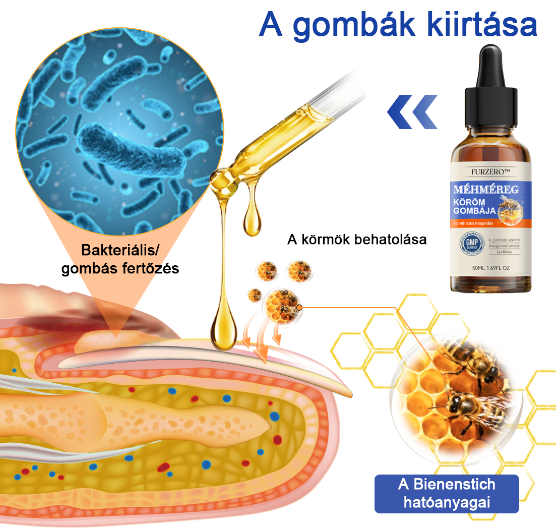 🐝🐝Furzero™ Méhméreg Körömgomba Kezelőoldat: Teljes megoldás a körömgomba problémájára🌟👣