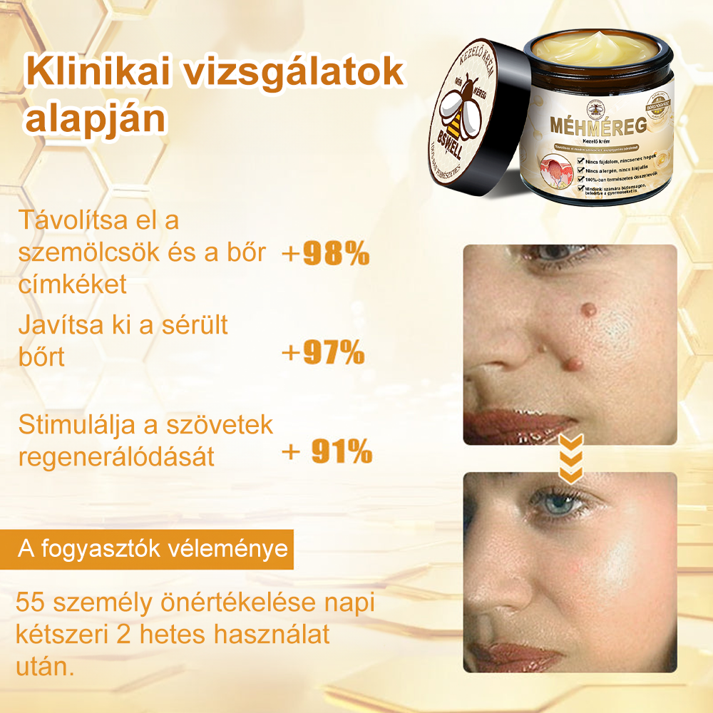 🐝💖BSWELL® Méhméreg Kezelés Krém👨‍⚕️（AAD ajánlott） (🔥utolsó nap promóció 80% ki